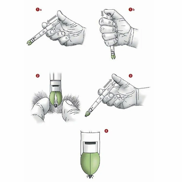 TickSAFE Zeckengreifer 4 TickSAFE Zeckengreifer – Bild 2